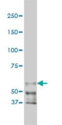 Western Blot: PAK1 Antibody (4D1) [H00005058-M02]