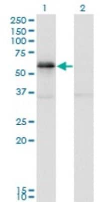 Western Blot: PAK1 Antibody (4D1) [H00005058-M02]