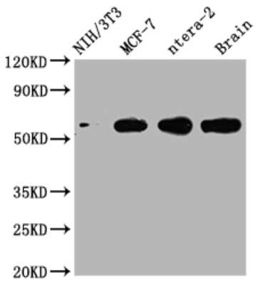 Western Blot: PAK1 Antibody (4F10) [NBP3-15141]