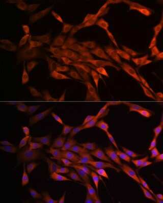 Immunocytochemistry/ Immunofluorescence: PAK1 Antibody (6R3M5) [NBP3-15811]