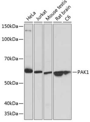 Western Blot: PAK1 Antibody (6R3M5) [NBP3-15811]