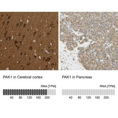 Immunohistochemistry-Paraffin: PAK1 Antibody [NBP1-85802]