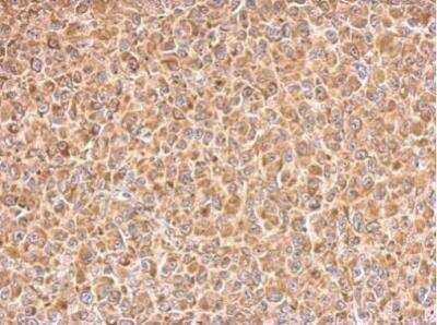 Immunohistochemistry-Paraffin: PAK1 Antibody [NBP2-19680]