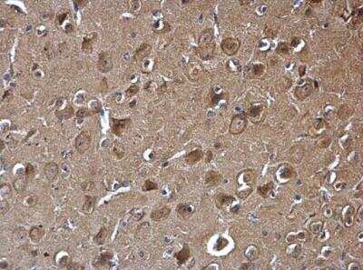 Immunohistochemistry-Paraffin: PAK1 Antibody [NBP2-19680]