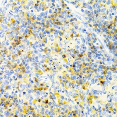 Immunohistochemistry-Paraffin: PAK1 Antibody - BSA Free [NBP3-04201]
