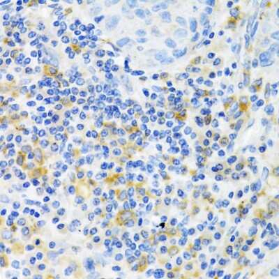 Immunohistochemistry-Paraffin: PAK1 Antibody - BSA Free [NBP3-04201]