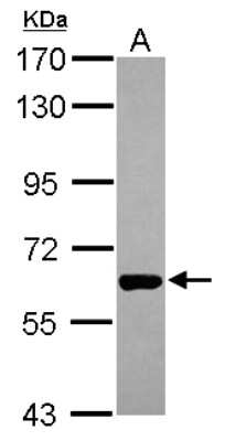 Western Blot: PAK1 Antibody [NBP2-19680]