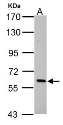 Western Blot: PAK1 Antibody [NBP2-19680]