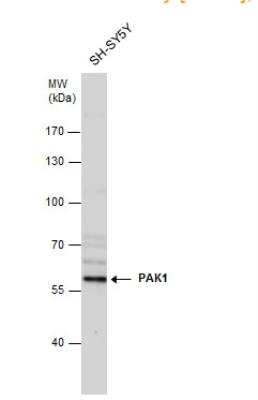 Western Blot: PAK1 Antibody [NBP2-19680]