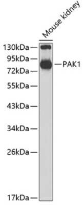 Western Blot: PAK1 AntibodyBSA Free [NBP3-04201]