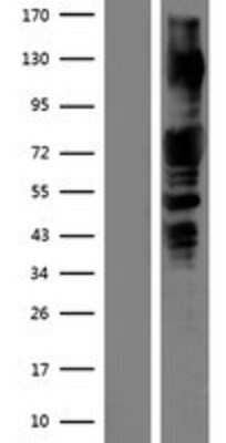 Western Blot: PAK1 Overexpression Lysate [NBP2-09482]