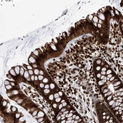 Immunohistochemistry-Paraffin: PAK1 interacting protein 1 Antibody [NBP1-90029]