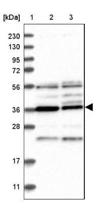 Western Blot: PAK1 interacting protein 1 Antibody [NBP1-90029]