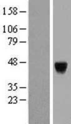 Western Blot: PAK1 interacting protein 1 Overexpression Lysate [NBL1-14079]