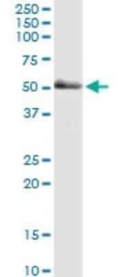 Western Blot: PAK2 Antibody (1E1) [H00005062-M01]