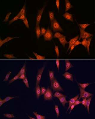 Immunocytochemistry/ Immunofluorescence: PAK2 Antibody (2Y7I2) [NBP3-16433]