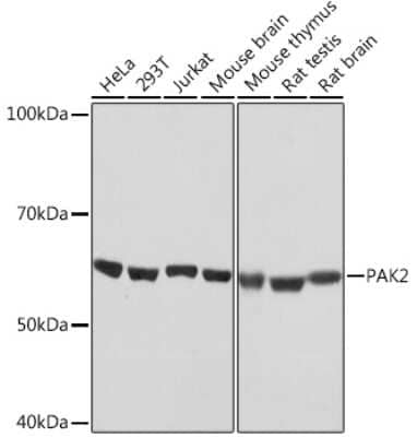 Western Blot: PAK2 Antibody (2Y7I2) [NBP3-16433]