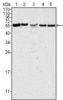 Western Blot: PAK2 Antibody (3B5)BSA Free [NBP1-47542]