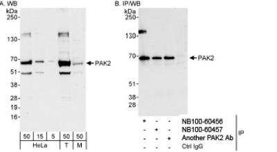 Western Blot: PAK2 Antibody [NB100-60456]