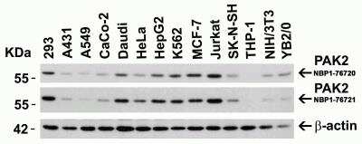 Western Blot: PAK2 AntibodyBSA Free [NBP1-76721]