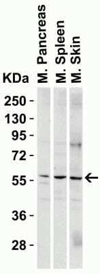 Western Blot: PAK2 AntibodyBSA Free [NBP1-76721]