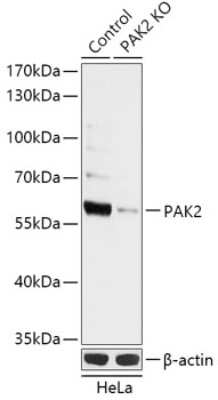 Western Blot: PAK2 AntibodyAzide and BSA Free [NBP3-03354]