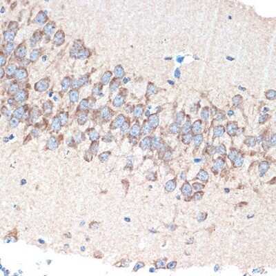 Immunohistochemistry-Paraffin: PAK3 Antibody (0K1I5) [NBP3-16173]