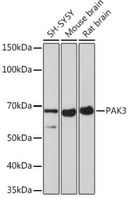 Western Blot: PAK3 Antibody (0K1I5) [NBP3-16173]