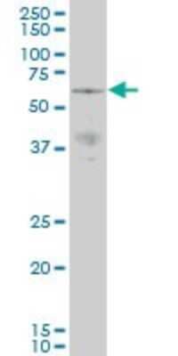 Western Blot: PAK3 Antibody (1H7) [H00005063-M07]