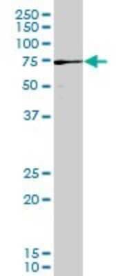 Western Blot: PAK3 Antibody (3A12) [H00005063-M08]