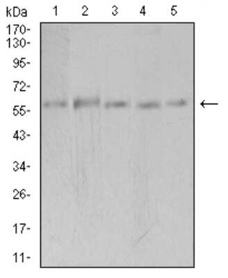 Western Blot: PAK3 Antibody (4G8F11)BSA Free [NBP2-61766]