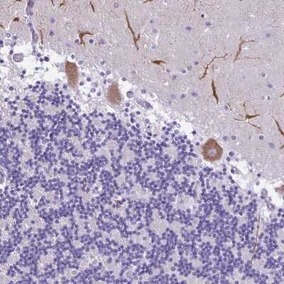 Immunohistochemistry: PAK3 Antibody [NBP2-38890]