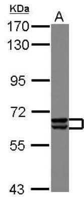 Western Blot: PAK3 Antibody [NBP2-19682]