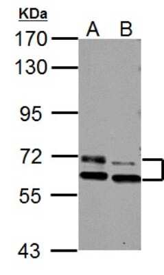 Western Blot: PAK3 Antibody [NBP2-19682]