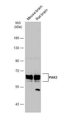 Western Blot: PAK3 Antibody [NBP2-19682]