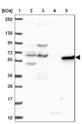 Western Blot: PAK3 Antibody [NBP2-38890]