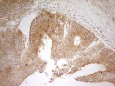 Immunohistochemistry: PAK4 Antibody (OTI1C7) [NBP2-46316]