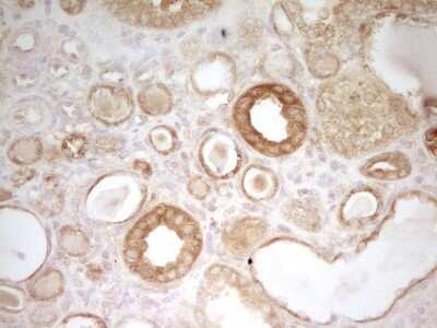 Immunohistochemistry: PAK4 Antibody (OTI1C7) [NBP2-46316]