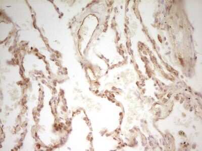 Immunohistochemistry: PAK4 Antibody (OTI1C7) [NBP2-46316]