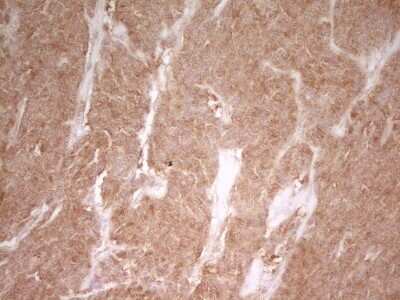 Immunohistochemistry: PAK4 Antibody (OTI1C7) [NBP2-46316]