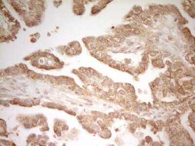 Immunohistochemistry: PAK4 Antibody (OTI1C7) [NBP2-46316]