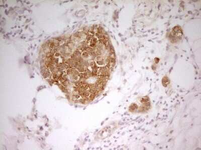 Immunohistochemistry: PAK4 Antibody (OTI1C7) [NBP2-46316]
