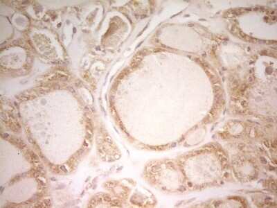 Immunohistochemistry: PAK4 Antibody (OTI1C7) [NBP2-46316]