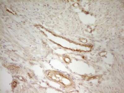 Immunohistochemistry: PAK4 Antibody (OTI1C7) [NBP2-46316]
