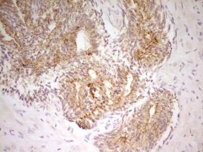 Immunohistochemistry: PAK4 Antibody (OTI1C7) [NBP2-46316]