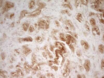 Immunohistochemistry: PAK4 Antibody (OTI1C7) [NBP2-46316]