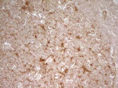 Immunohistochemistry: PAK4 Antibody (OTI1C7) [NBP2-46316]