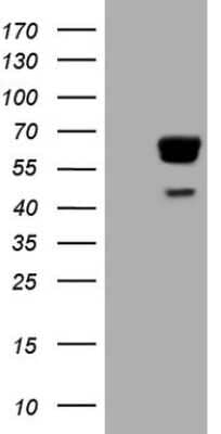 Western Blot: PAK4 Antibody (OTI1C7) [NBP2-46316]