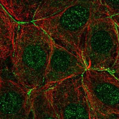 Immunocytochemistry/ Immunofluorescence: PAK4 Antibody [NBP2-58833]