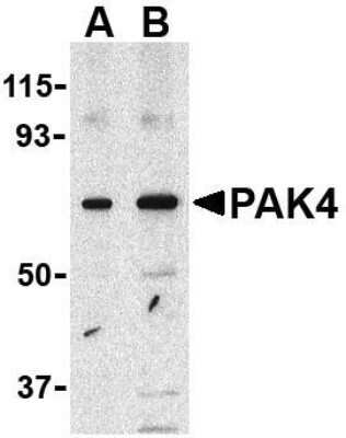 Western Blot: PAK4 AntibodyBSA Free [NBP1-77236]